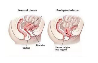 坐月子能洗澡洗头吗,请看科学坐月子的指南 坐月子能洗澡洗头吗,请看科学坐月子的指南