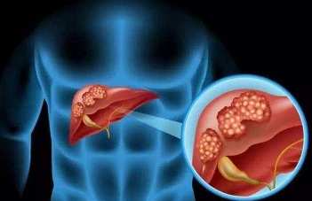 养肝“霸主”已找到，不是枸杞，平时多吃吃，修复肝细胞
