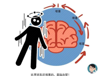 血管变窄的男人，通常有4个特征，若占3个以上，可能中风正在靠近