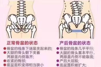 产后屁股变大？原来真正的幕后黑手是它！