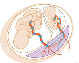 试管婴儿生双胞胎的机率有多大？