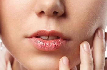 嘴唇出现3种表现，证明脾胃不好，需要提高警惕调理下
